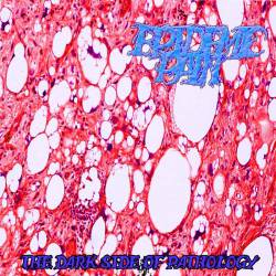 Epidemic Pain : Dark Side of Pathology Epidemic Pain : Dark Side of Pathology